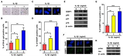 Interleukin-1β Drives Cellular Senescence of Rat Astrocytes Induced by Oligomerized Amyloid β Peptide and Oxidative Stress